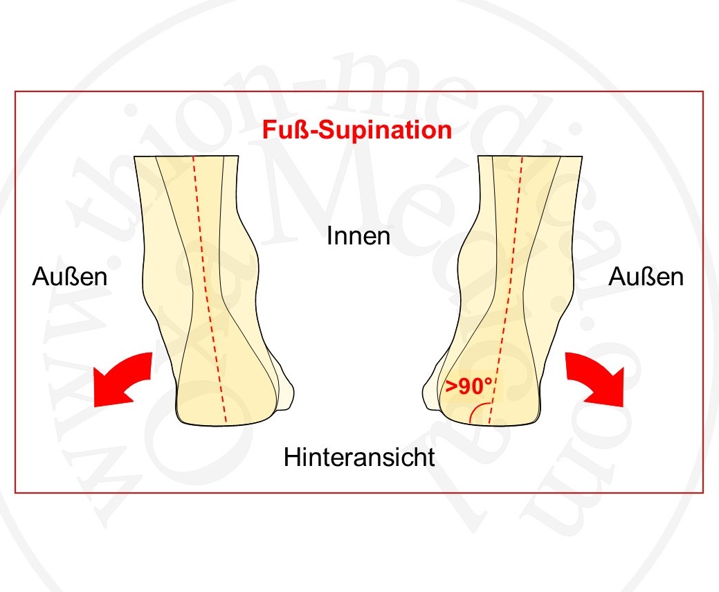Diagramm der Fuß-Supination